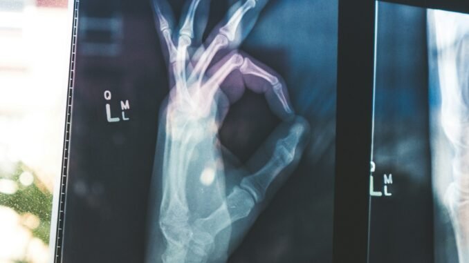 Google's open MedGemma AI models could transform healthcare